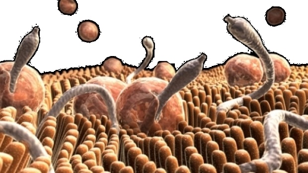 deparazitarea parazitilor intestinali