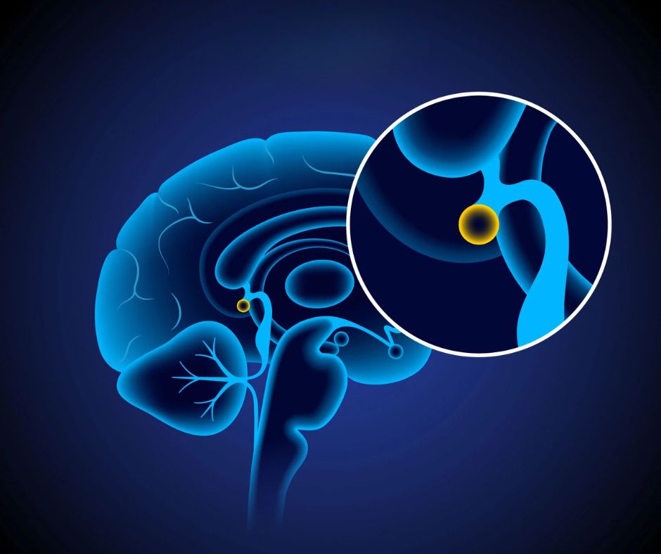 Glanda pineală (epifiza) – roluri în organism, importanța și metode de decalcifere