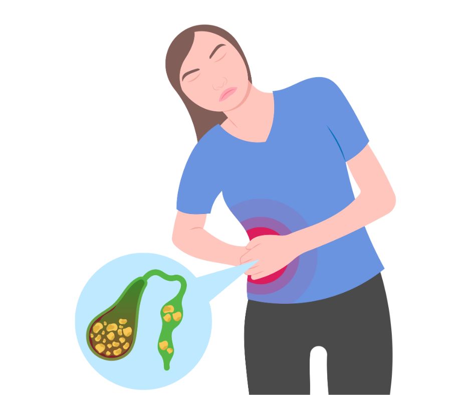 Dischinezia biliară sau fiere leneșă: cauze, declanșatori, regim alimentar și tratamente naturale Dischinezia biliară sau fiere leneșă: cauze, declanșatori, regim alimentar și tratamente naturale